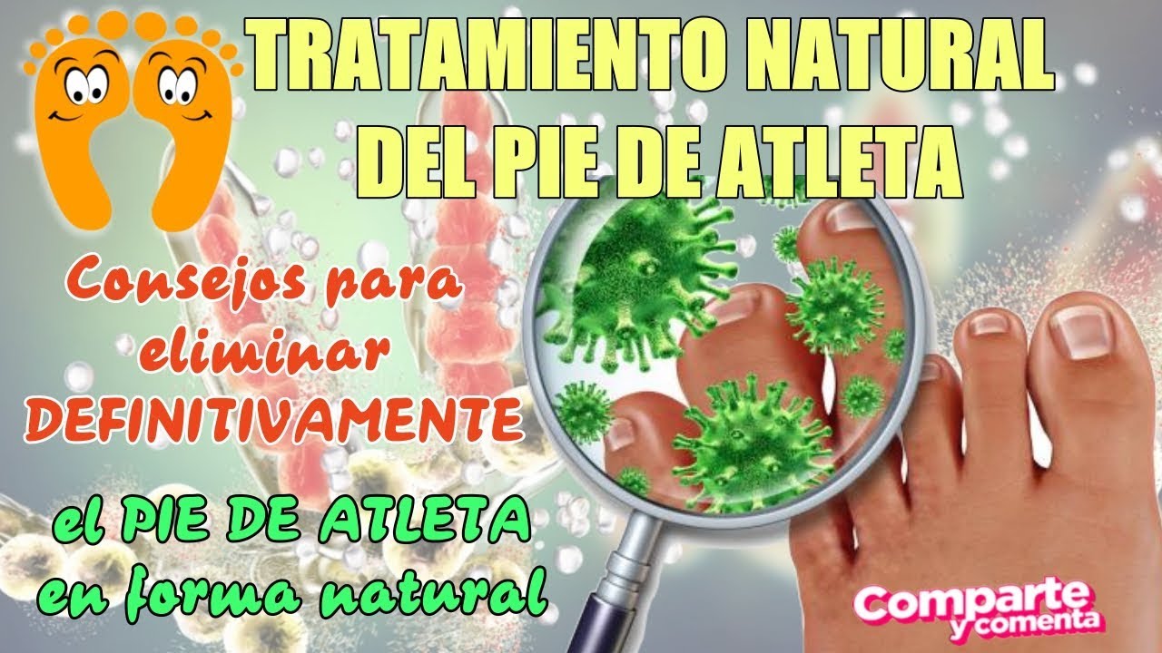 Pie de Atleta Tratamiento 5 Remedios Caseros para Hongos en los Pies