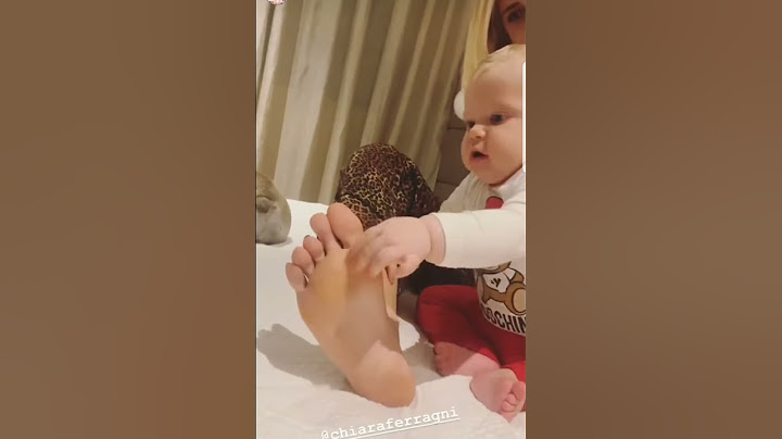 CHIARA FERRAGNI HA I CALLI AI PIEDI