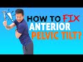 Anterior Pelvic Tilt Correction And How To Fix Bad Posture
