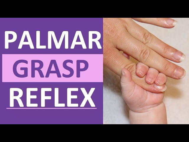Palmar Grasp Reflex Reaction Infant Newborn Pediatric Nursing Assessment class=