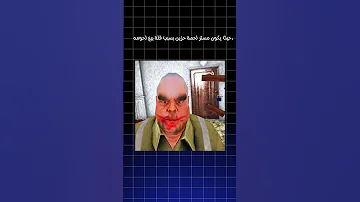 حقيقة سر مستر لحمة 
