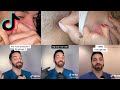 Pimple popping  dermdoctor  pimple extraction  tiktok compilation 2022