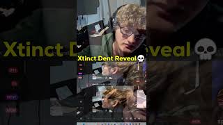 Bro showed his headset dent💀