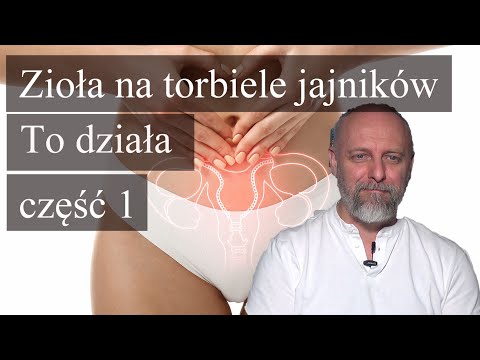 Wideo: 3 sposoby na opróżnienie torbieli