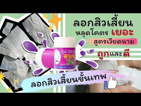 [Review] รีวิวที่ลอกสิวเสี้ยนเวียดนาม Gel Hut Mun White ถูกและดีมากเวอร์ หลุดยันโคน || BCS