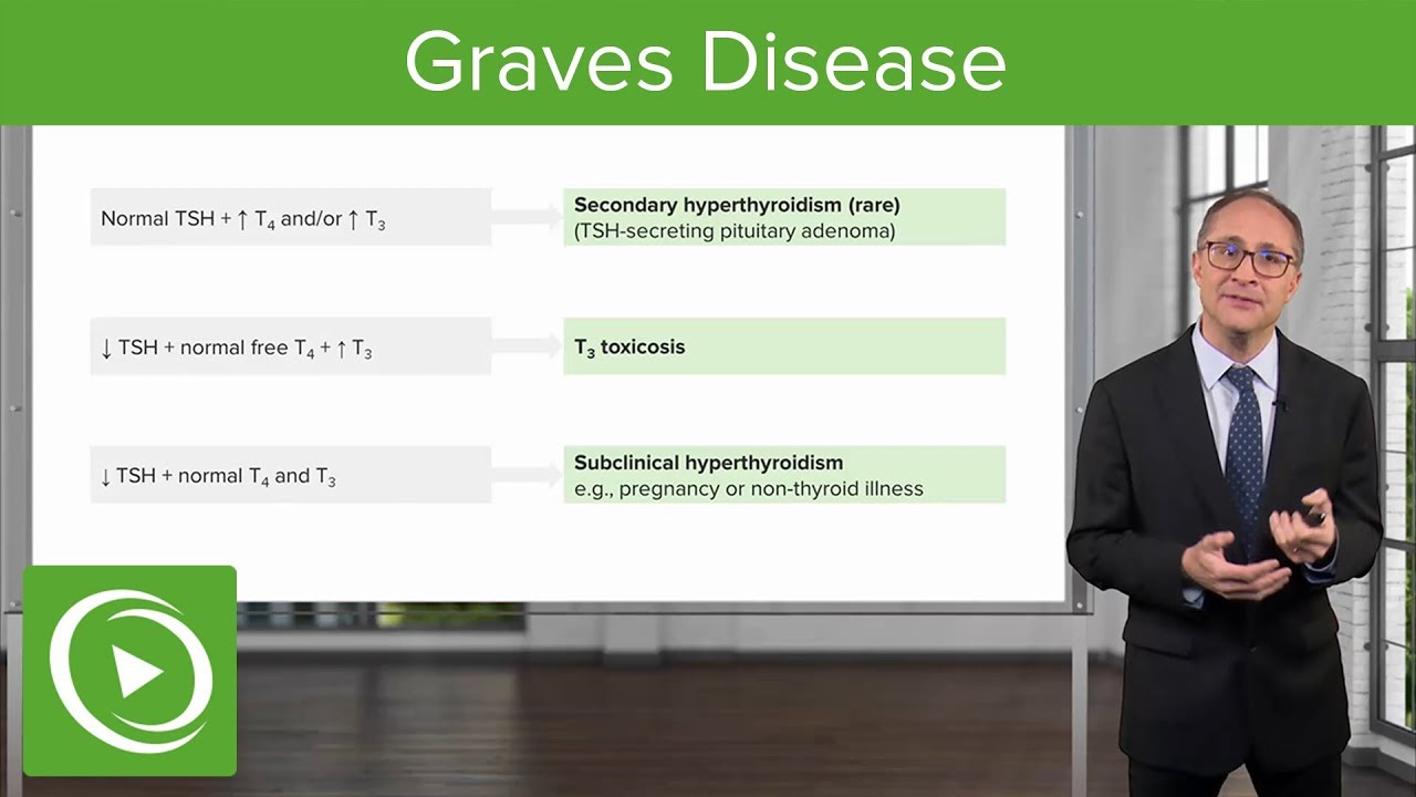 Graves Disease – Endocrinology | Lecturio