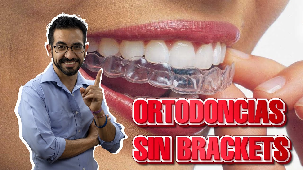 Ortodoncia Invisible y Sin Brackets: Invisalign y Carriere Motion. TuDentistadeConfianza