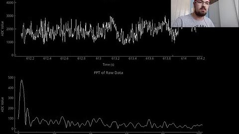 Demonstration of a Low Cost EEG Circuit