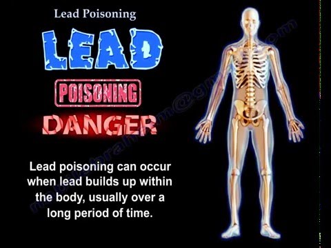 Lead Poisoning  - Everything You Need To Know - Dr. Nabil Ebraheim