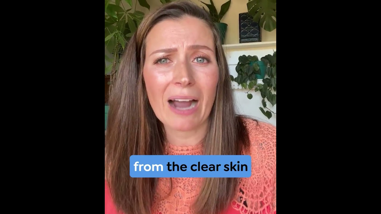 Facial issues AD-VSL