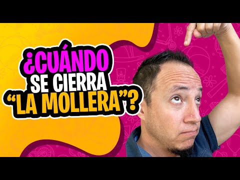 Video: ¿A qué edad se cierra la fontanela de un bebé?