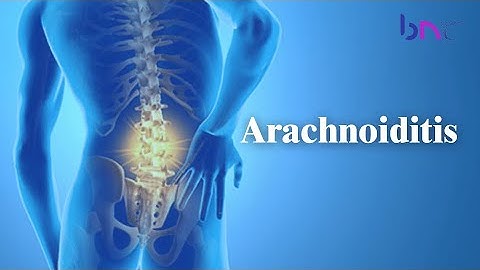 What is Arachnoiditis | Arachnoiditis Causes | Arachnoiditis Treatment | Spine Care | BNC