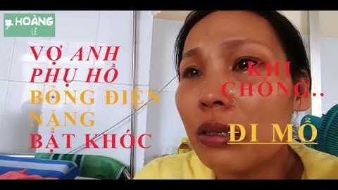 Vợ anh phụ hồ bỏng điện nặng bật khóc khi chồng đi mổ, được giúp trăm triệu nhưng không đủ...