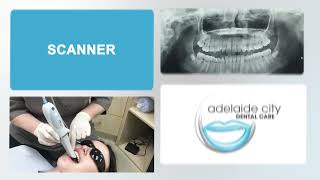 Scanning teeth