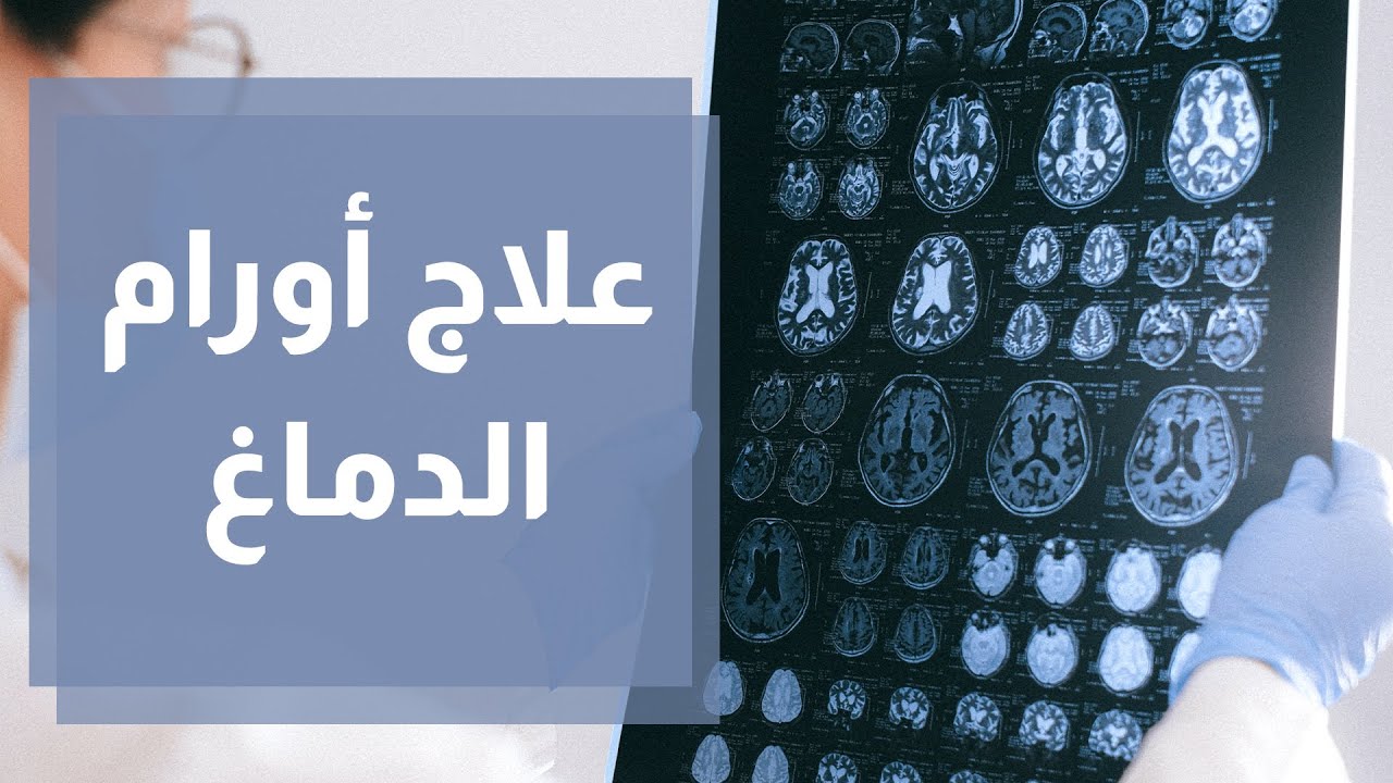 علاج أورام وأمراض الدماغ دون جراحة بأشعة الجاما نايف