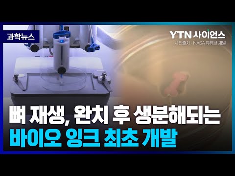 [과학뉴스] 국내 연구진, 부러진 뼈에 바르면 재생.. 완치 후 사라지는 바이오 잉크 개발.. 상용화 가능성 앞당겨 / 23.04.04