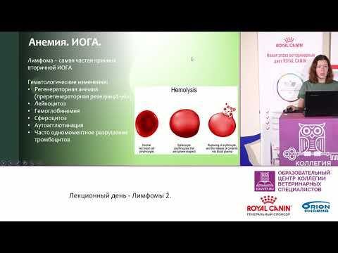 Видео: Малые лимфоцитарные лимфомы (SLL): симптомы, лечение и многое другое