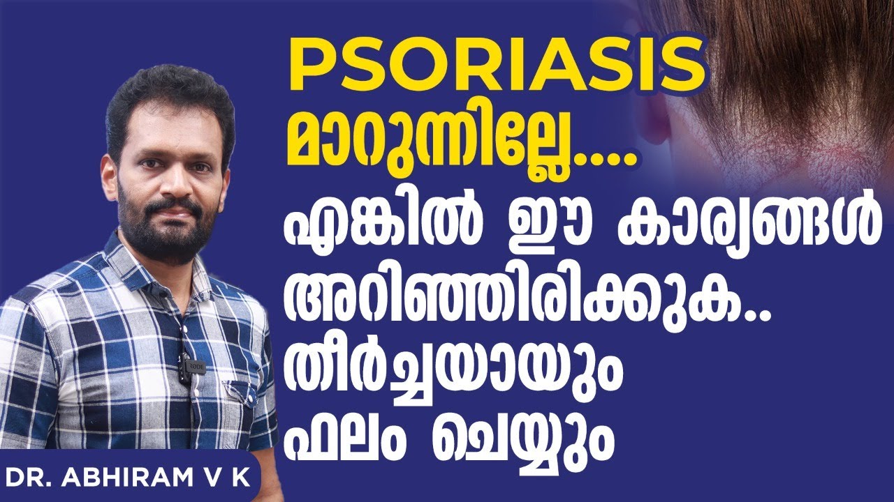 Psoriasis മാറുന്നില്ലെ | എങ്കിൽ ഈ കാര്യങ്ങൾ കൂടെ അറിഞ്ഞിരിക്കുക | Psoriasis Malayalam | Dr Abhiram