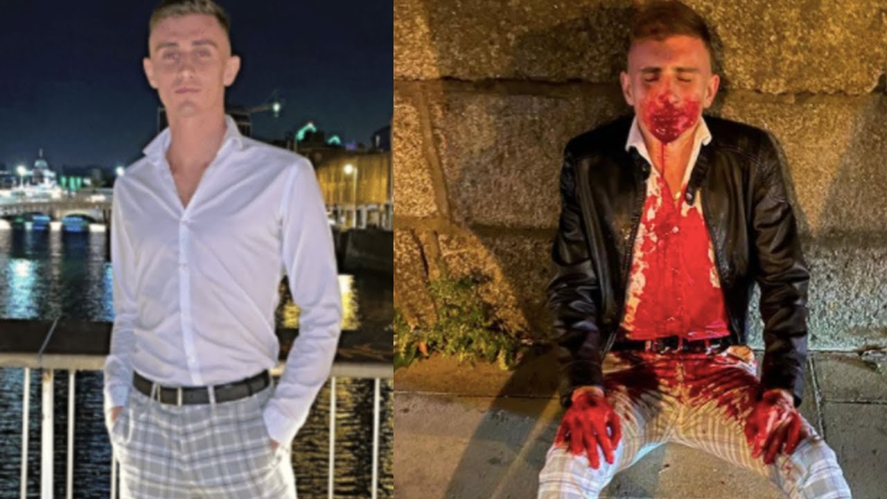 Irish Olympian attacked on Dublin street by gang of 12, leaving him needing surgery