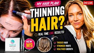 Can Microneedling Help Thinning Hair? Hanheal Hair Filler + Dr. Pen M9 (LIVE)