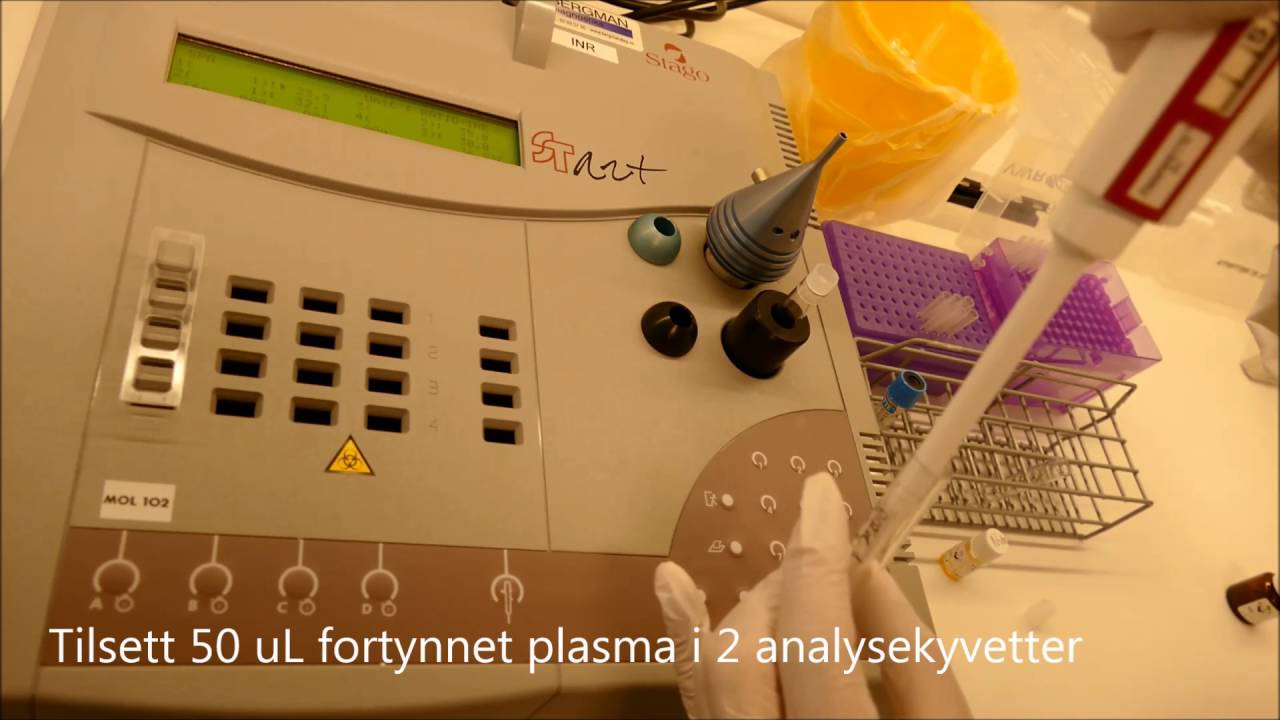 PT-INR ved bruk av Stago Start koagulometer - YouTube