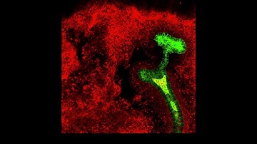Ureteric bud branching