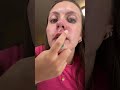 Take off my pimple patches #pimplepatch #satisfying #asmr #pimple #acne #pimpleremover #spotcream