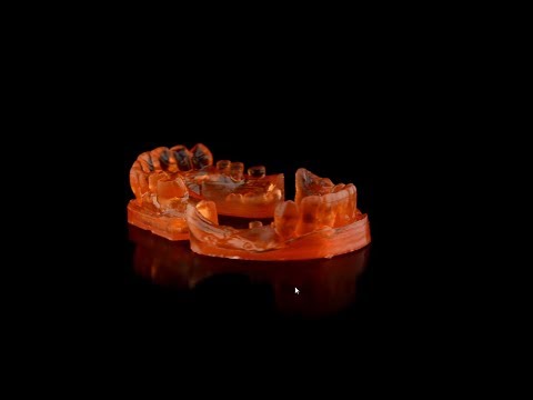 Oxi Dental presents - Digital wax up created with 3D printer.