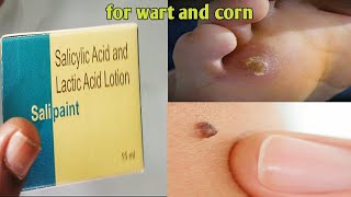 Salipaint lotion uses in hindi salipaint lotion price salipaint for wart corn removal salipaint screenshot 3