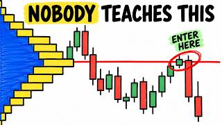 The Real Reason Your Volume Profile Trades Keep FAILING (Trading Strategy) Update