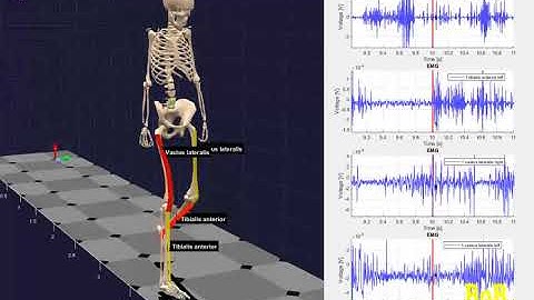 EMG signals during gait