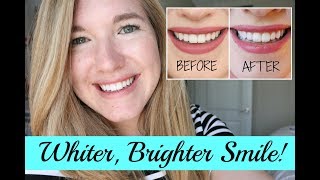 How I got a Whiter, Brighter Smile! ♥