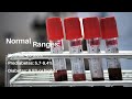 HbA1C