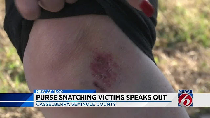 Purse snatching victims speaks out