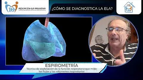 ¿Puede un EMG diagnosticar la ELA?