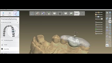 How to design a Positioning Abutment Guide in 3Shape