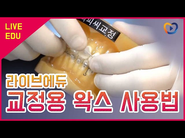 [라이브에듀] 교정용 왁스 사용법