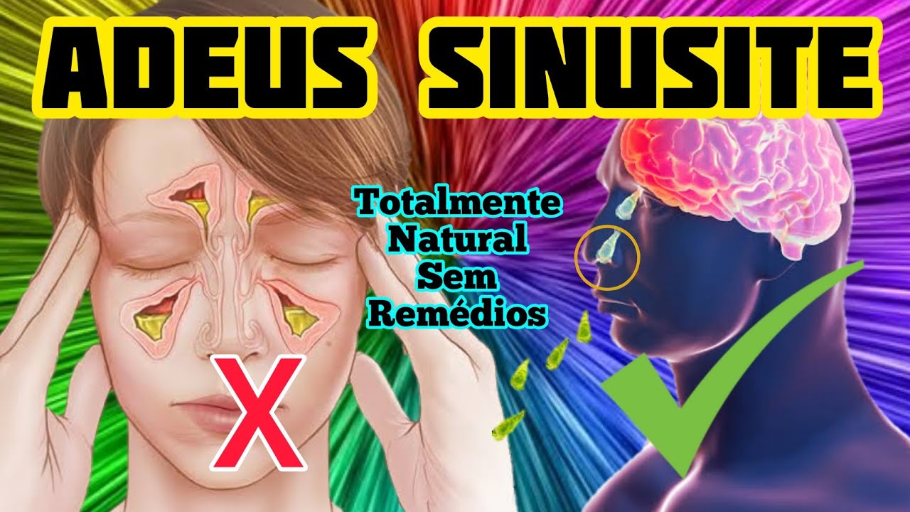 Sinusite Atacada O Que Fazer? Exercícios Para Se Livrar Da Sinusite ...