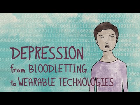 Depression: From Bloodletting to Wearable Devices