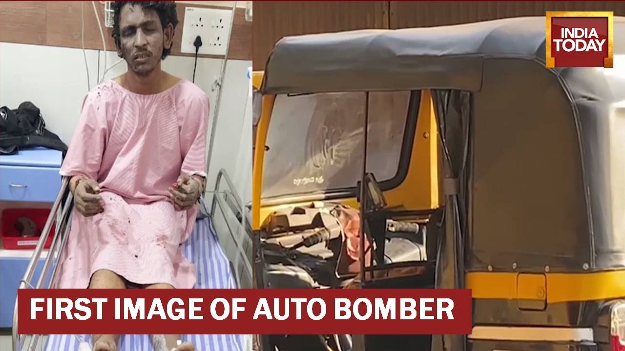 First Images Of Auto Bomber Mohammed Shariq, A Terror Accused On The Run | Mangaluru Auto Blast