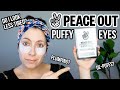 PEACE OUT PUFFY EYES | Review