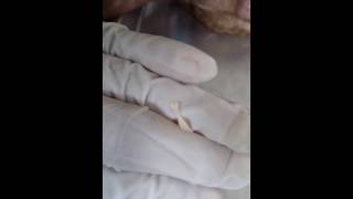 Dipylidium caninum proglotide