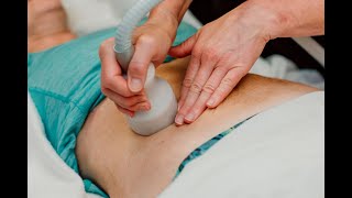 CryoSkin Slim