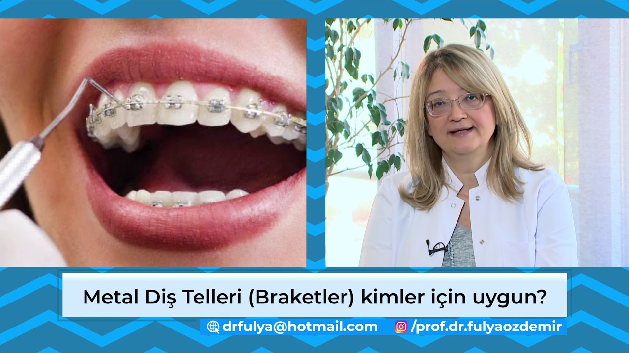 BRAKET ve TEL ÇEŞİTLERİ - PROF. DR. FULYA ÖZDEMİR