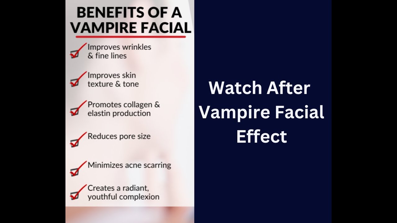 Vampire Rinkles Say Goodbye to Wrinkles and Hello to Radiant Skin with the Vampire ...
