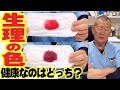 意外と知らない生理の正しい血の色!健康なのはどっちかわかるかな?