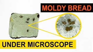 Moldy Bread Magnified Under Microscope
