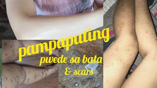 PAMPAPUTING PWEDE SA BATA|SCAR REMOVER Ms Sungit