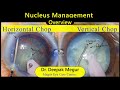 Phaco basicsnucleus management pearls  pitfalls  dr deepak megur