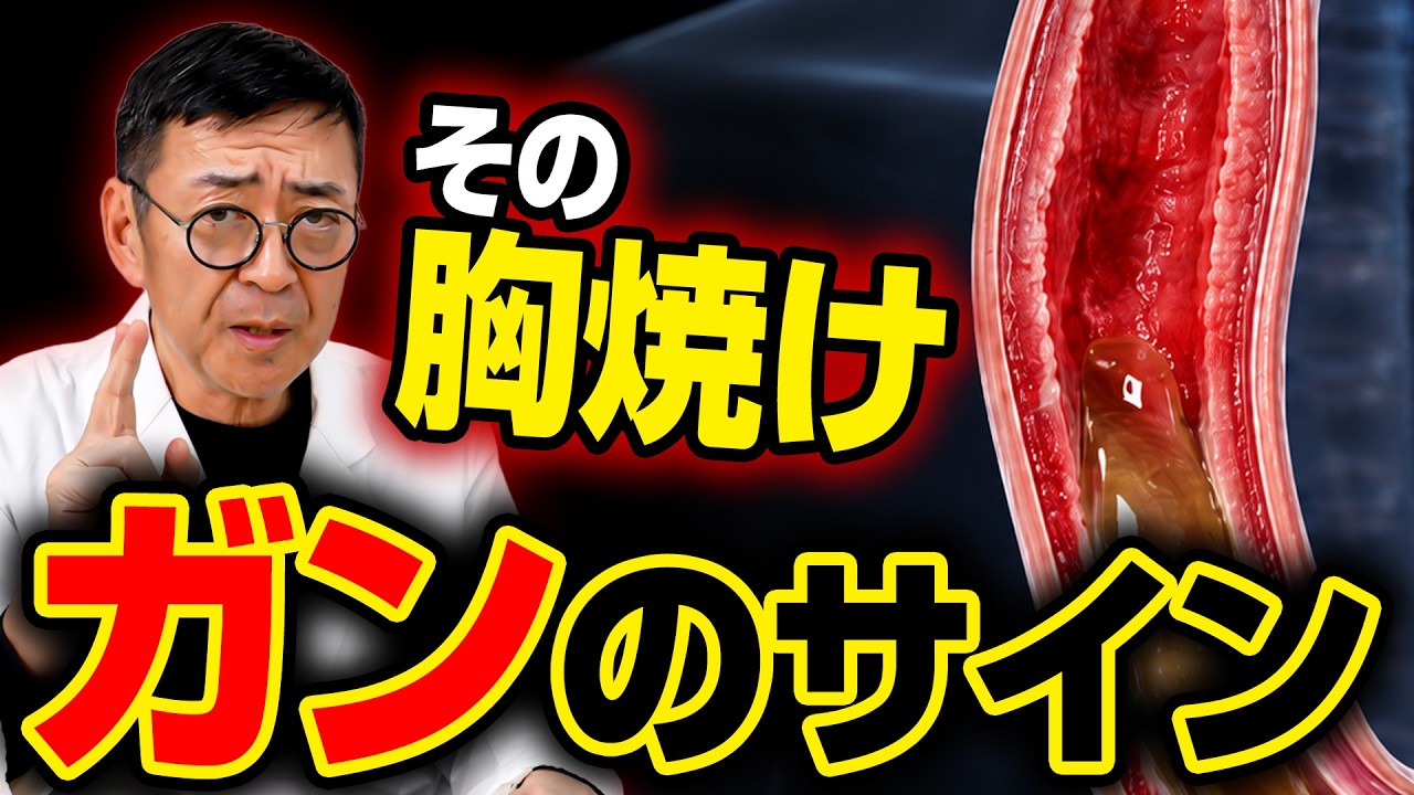 【放置厳禁】胸焼け・酸っぱいげっぷは食道がんへの 危険サイン!逆流性食道炎を根本から治す4つの最新医学アプローチ